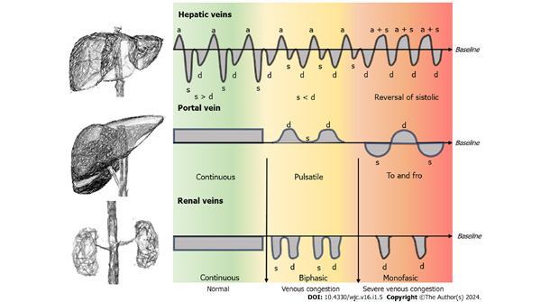 World Journal of Cardiology - Baishideng Publishing Group