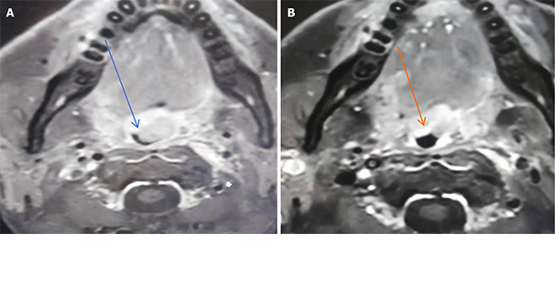 World Journal of Clinical Oncology - Baishideng Publishing Group