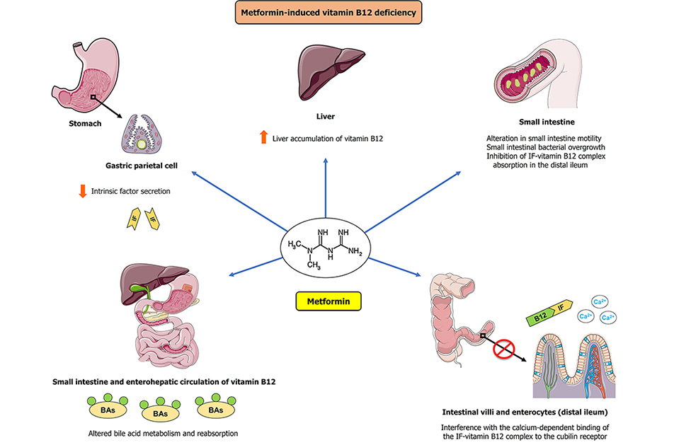 WORLD JOURNAL OF DIABETES (2010 - )