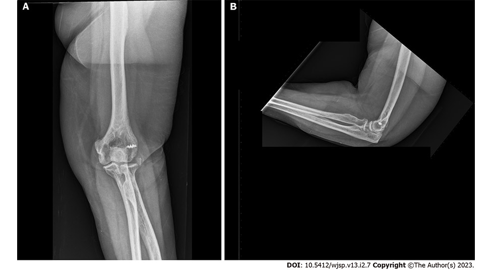 World Journal of Surgical Procedures - Baishideng Publishing Group